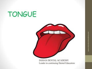 TONGUE
www.indiandentalacademy.com
INDIAN DENTAL ACADEMY
Leader in continuing Dental Education
 