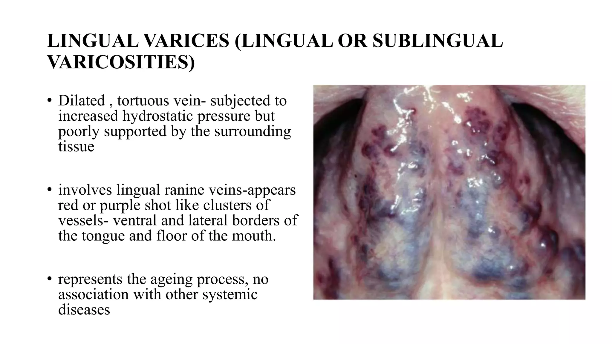 anatomy-of-tongue-pptx