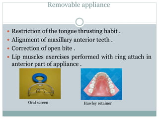 Removable appliance
 Restriction of the tongue thrusting habit .
 Alignment of maxillary anterior teeth .
 Correction of open bite .
 Lip muscles exercises performed with ring attach in
anterior part of appliance .
Oral screen Hawley retainer
 