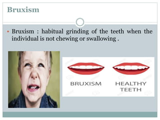 Bruxism
 Bruxism : habitual grinding of the teeth when the
individual is not chewing or swallowing .
 