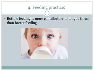 :4. Feeding practice
 Bottole feeding is more contributory to tongue thrust
than breast feeding .
 