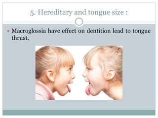 5. Hereditary and tongue size :
 Macroglossia have effect on dentition lead to tongue
thrust.
 