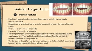 Proclined, spaced, and sometimes flared upper anteriors resulting in
increased overjet
Retroclined or proclined lower anteriors depending upon the type of tongue
thrust
Presence of an anterior open bite
Presence of posterior crossbites
The simple tongue thrust is characterised by a normal tooth contact during
swallowing act. They exhibit good intercuspation of posterior teeth in
contrast to complex tongue thrust
The tongue is thrust foward durimg swallowing to help establish an anterior
lip seal. At rest tongue tip lies at a lower level.
2.
Anterior Tongue Thrust
Intraoral Features
 