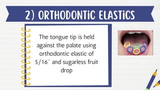 2) orthodontic elastics
The tongue tip is held
against the palate using
orthodontic elastic of
5/16" and sugarless fruit
drop
 