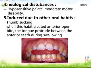 LOGO4.neulogical distubances :
→ Hyposensitive palate, moderate motor
disability.
5.Induced due to other oral habits :
→Thumb sucking
→when this habit created anterior open
bite, the tongue protrude between the
anterior teeth during swallowing
 