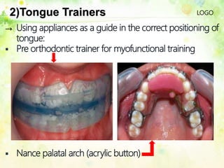 LOGO2)Tongue Trainers
 