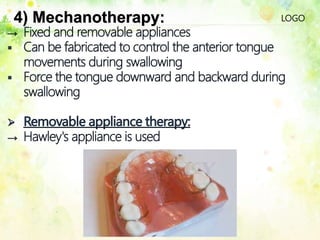 LOGO4) Mechanotherapy:
 