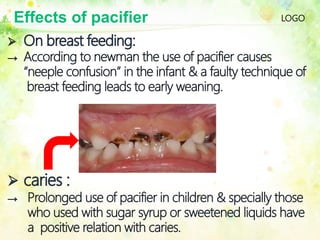 LOGOEffects of pacifier
 