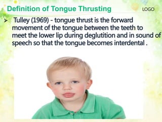 LOGODefinition of Tongue Thrusting
 