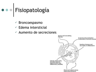 Fisiopatología Broncoespasmo Edema intersticial Aumento de secreciones 