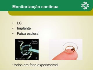 Monitorização contínua
• LC
• Implante
• Faixa escleral
*todos em fase experimental
 
