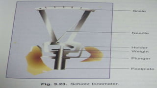 Tonometer Small Pin Tonometer | PPTX