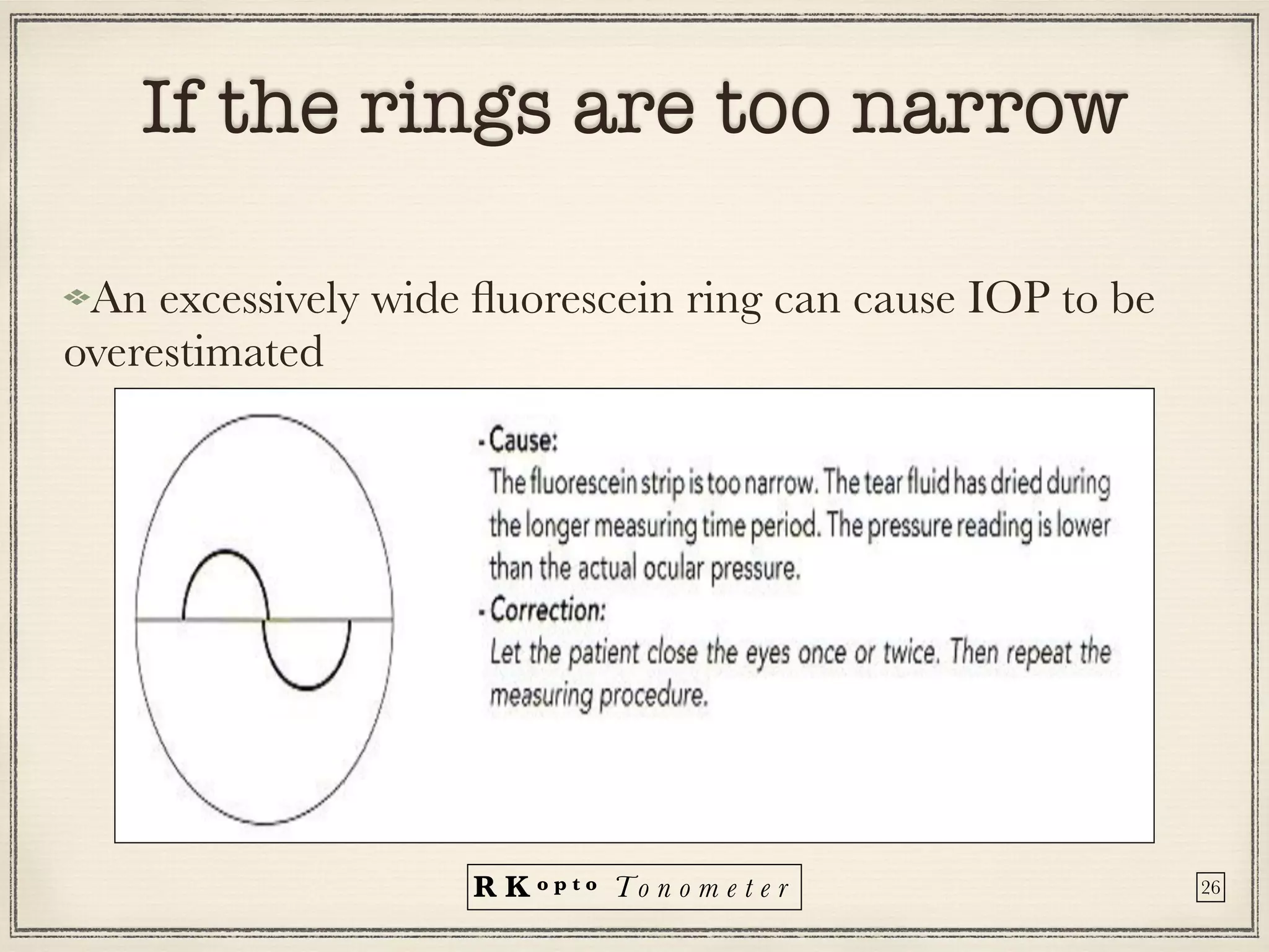 R K o p t o To n o m e t e r
If the rings are too narrow


An excessively wide
fl
uorescein ring can cause IOP to be
overestimated
26
 