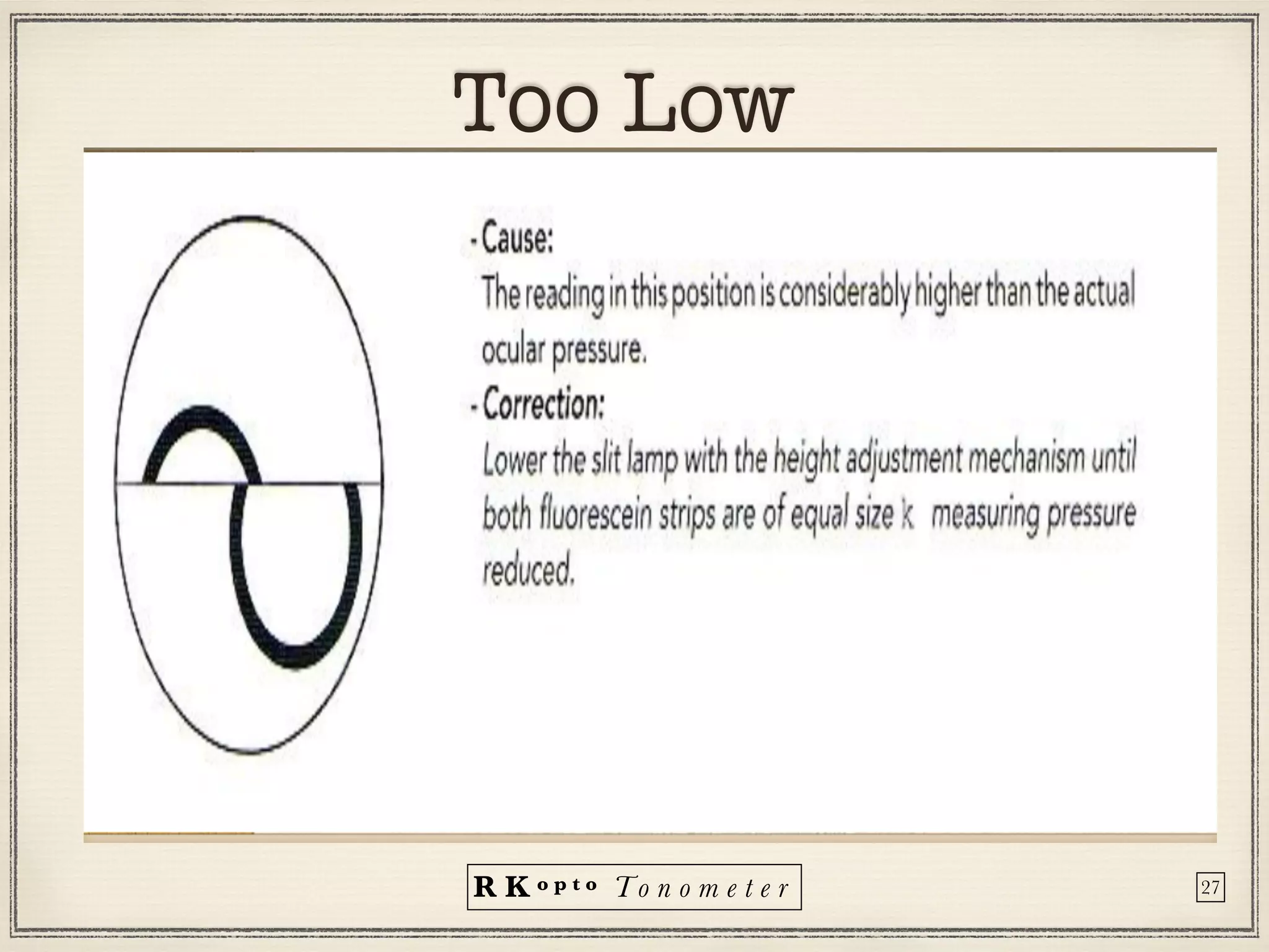 R K o p t o To n o m e t e r
Too Low
27
 