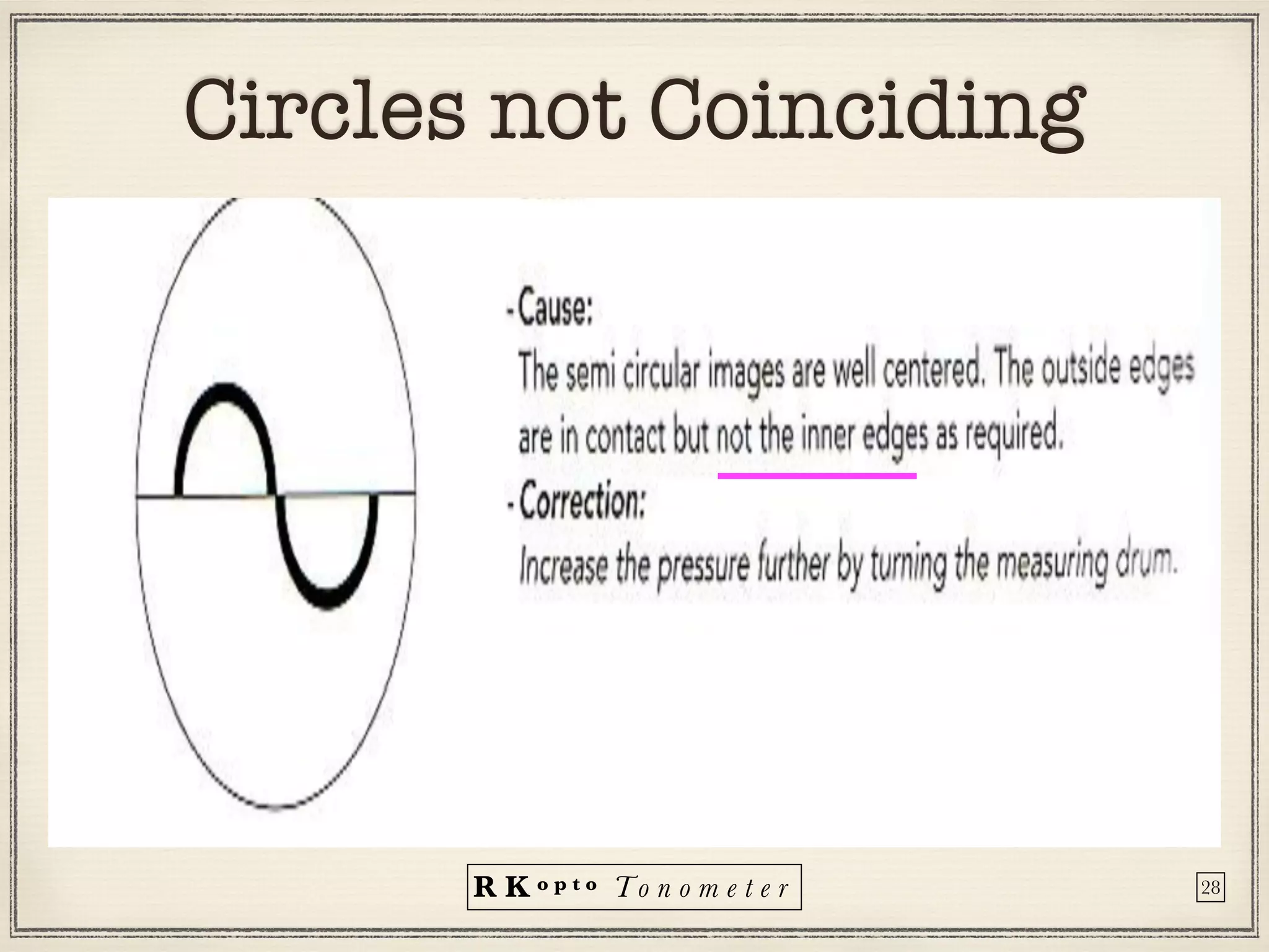 R K o p t o To n o m e t e r
Circles not Coinciding
28
 