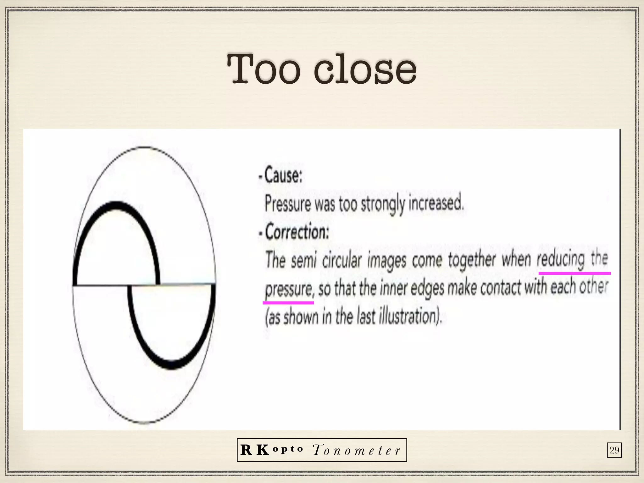 R K o p t o To n o m e t e r
Too close
29
 