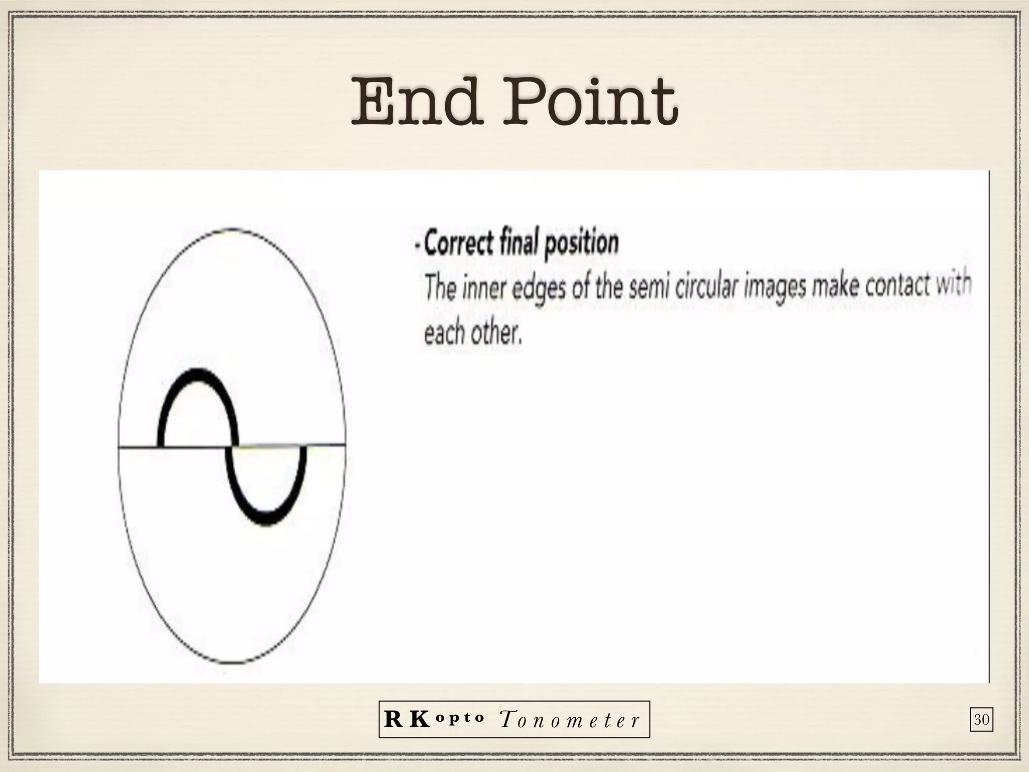 R K o p t o To n o m e t e r
End Point
30
 