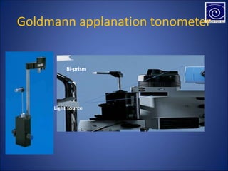 Goldmann applanation tonometer
Bi-prism
Light source
 