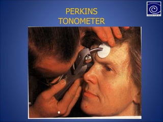 PERKINS
TONOMETER
 