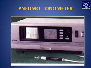 PNEUMO TONOMETER
 