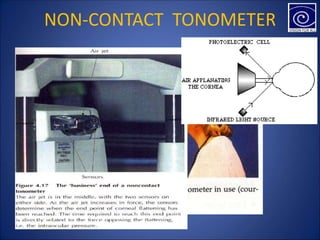NON-CONTACT TONOMETER
 