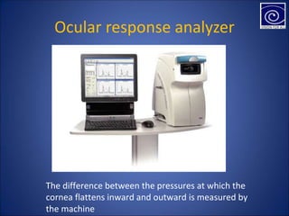 Ocular response analyzer
The difference between the pressures at which the
cornea flattens inward and outward is measured by
the machine
 