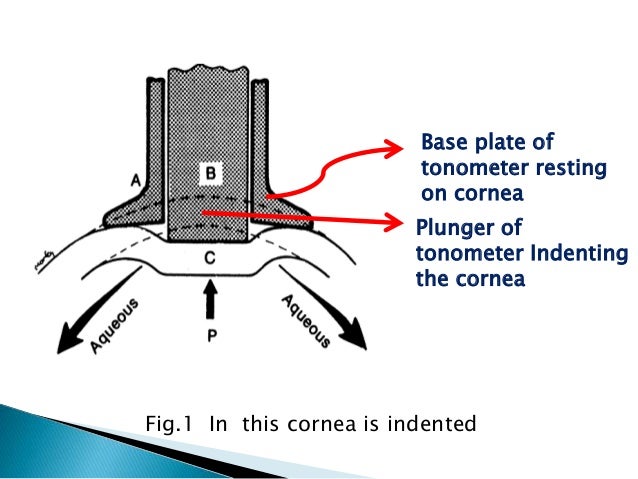 tonometry schiotz tonometer reading chart