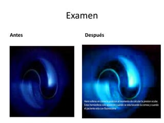 Examen
Antes Después