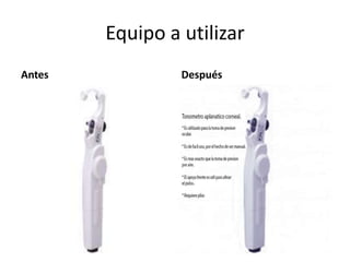 Equipo a utilizar
Antes Después