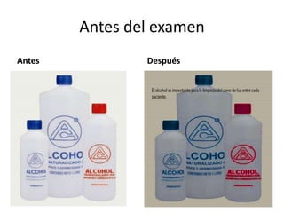 Antes del examen
Antes Después