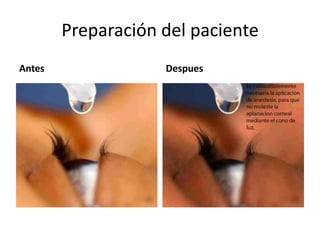 Preparación del paciente
Antes Despues