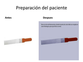 Preparación del paciente
Antes Despues