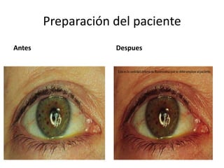 Preparación del paciente
Antes Despues