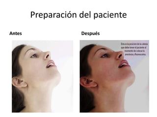 Preparación del paciente
Antes Después