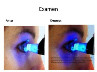 Examen
Antes Despues