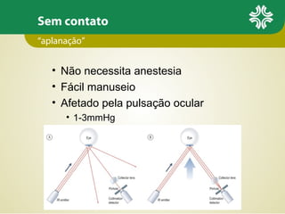 Sem contato
• Não necessita anestesia
• Fácil manuseio
• Afetado pela pulsação ocular
• 1-3mmHg
“aplanação”
 
