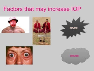 Factors that may increase IOP
 