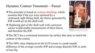 Tonometry.pptx