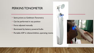 PERKINS TONOMETER
• Same prisms as Goldmann Tonometry
• Can be performed in any position
• Force adjusted manually
• Illuminated by battery powered bulbs
• Portable–IOP in infants/children, operating rooms
 