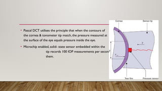 • Pascal DCT utilises the principle that when the contours of
the cornea & tonometer tip match, the pressure measured at
the surface of the eye equals pressure inside the eye.
• Microchip enabled, solid- state sensor embedded within the
tip records 100 IOP measurements per second and averages
them.
 
