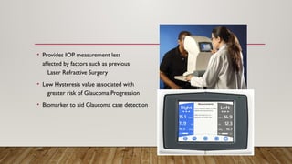 • Provides IOP measurement less
affected by factors such as previous
Laser Refractive Surgery
• Low Hysteresis value associated with
greater risk of Glaucoma Progression
• Biomarker to aid Glaucoma case detection
 
