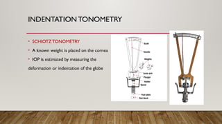 INDENTATION TONOMETRY
• SCHIOTZTONOMETRY
• A known weight is placed on the cornea
• IOP is estimated by measuring the
deformation or indentation of the globe
 