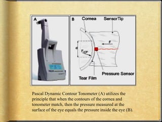 Different types of Tonometry | PPTX