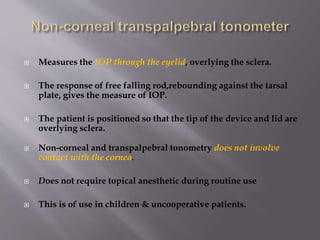 Tonometry and tonography | PPTX