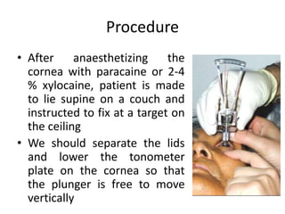 Procedure
• After anaesthetizing the
cornea with paracaine or 2-4
% xylocaine, patient is made
to lie supine on a couch and
instructed to fix at a target on
the ceiling
• We should separate the lids
and lower the tonometer
plate on the cornea so that
the plunger is free to move
vertically
 