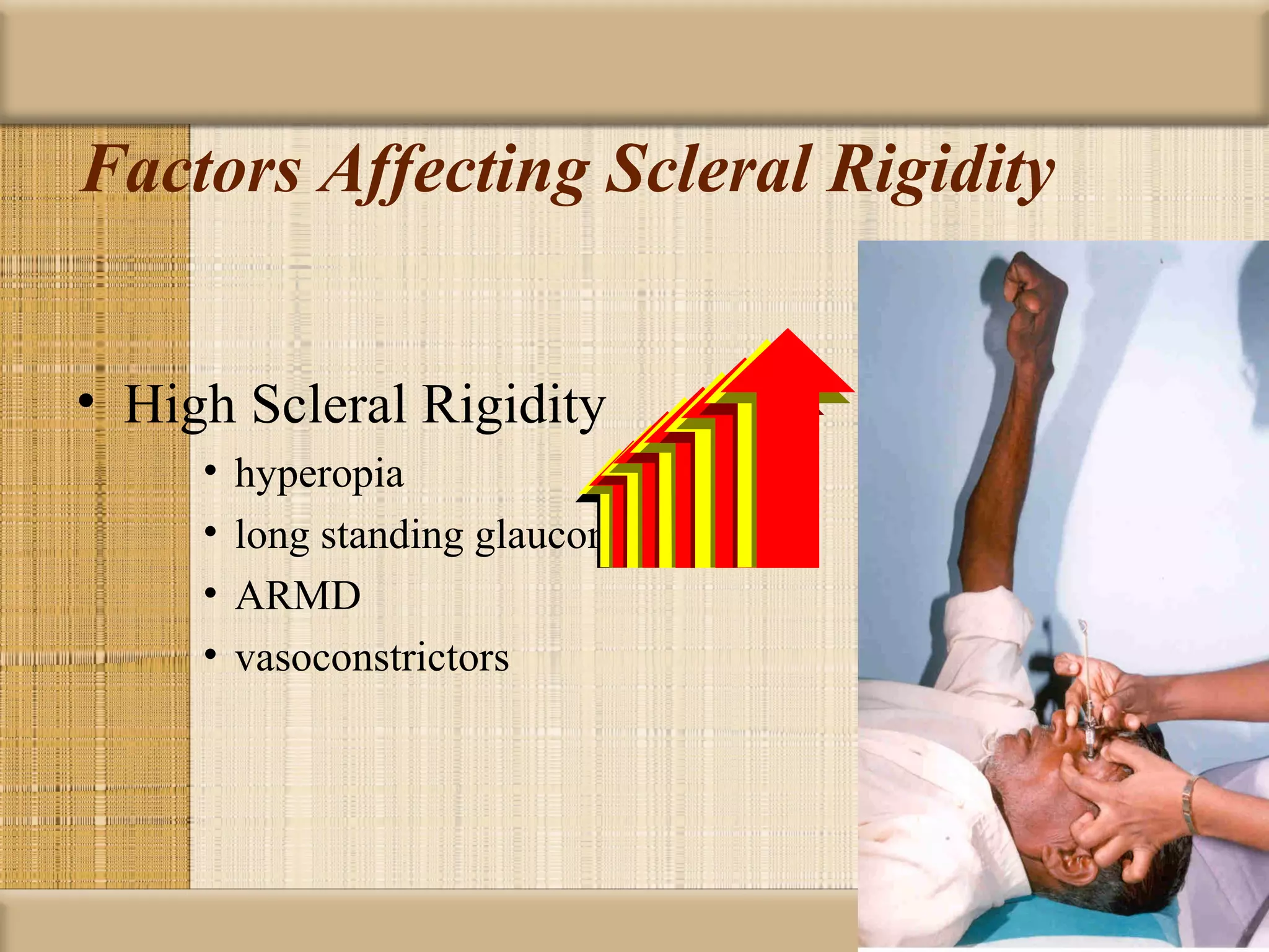 Factors Affecting Scleral Rigidity


• High Scleral Rigidity
     •   hyperopia
     •   long standing glaucoma
     •   ARMD
     •   vasoconstrictors
 