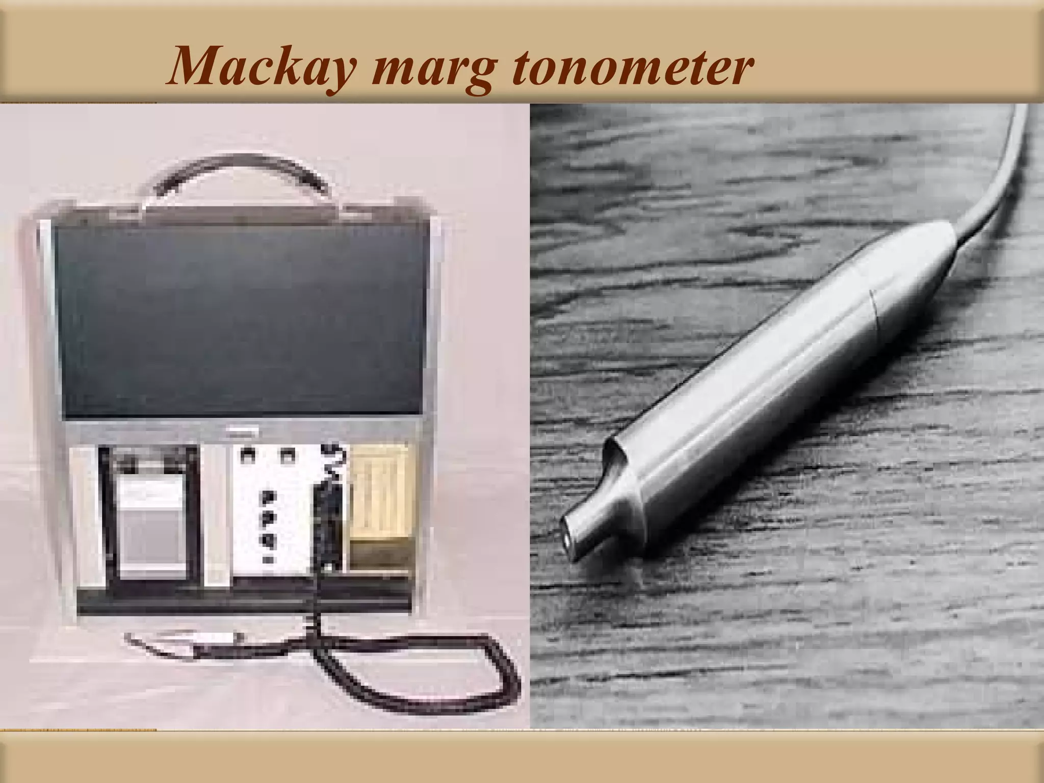 Mackay marg tonometer
 