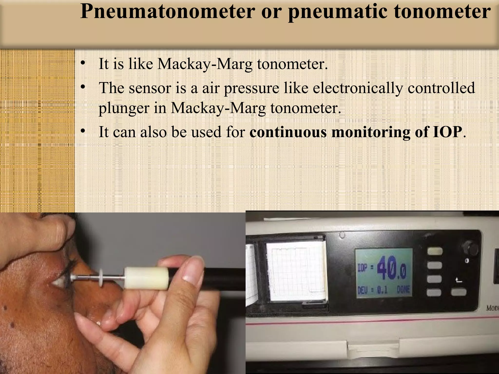 Pneumatonometer or pneumatic tonometer 

• It is like Mackay-Marg tonometer.
• The sensor is a air pressure like electronically controlled
  plunger in Mackay-Marg tonometer.
• It can also be used for continuous monitoring of IOP.
 