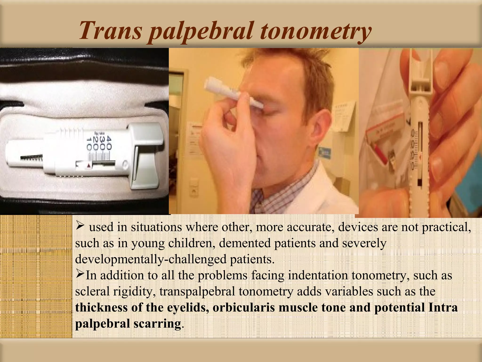 Trans palpebral tonometry




 used in situations where other, more accurate, devices are not practical,
such as in young children, demented patients and severely
developmentally-challenged patients.
In addition to all the problems facing indentation tonometry, such as
scleral rigidity, transpalpebral tonometry adds variables such as the
thickness of the eyelids, orbicularis muscle tone and potential Intra 
palpebral scarring.
 