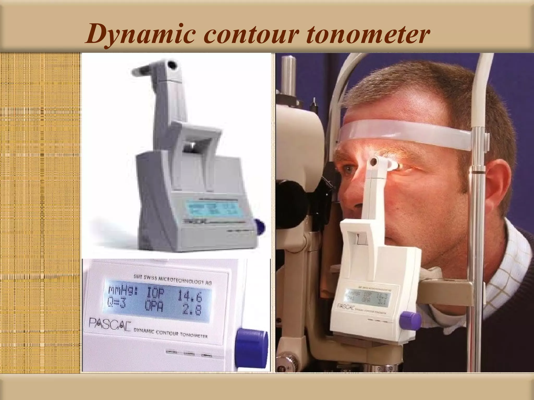 Dynamic contour tonometer
 